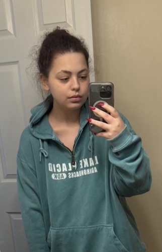 Kiana D. DLBCL
