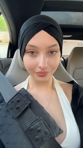 Rhea G. Hodgkin lymphoma