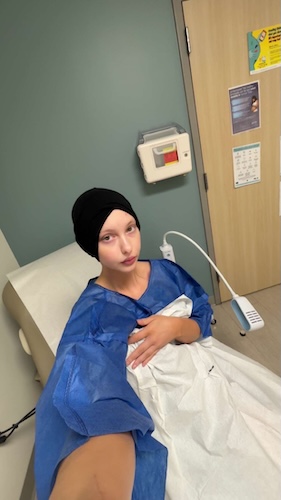 Rhea G. Hodgkin lymphoma