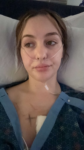 Rhea G. Hodgkin lymphoma