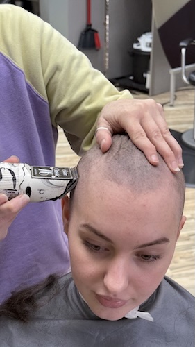 Rhea G. Hodgkin lymphoma